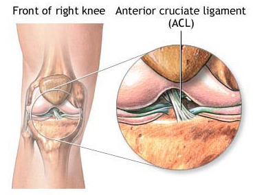 ACL- Anterior Cruciate Ligament